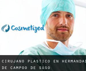 Cirujano Plástico en Hermandad de Campoo de Suso