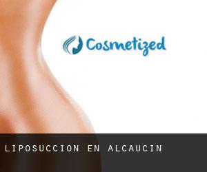 Liposucción en Alcaucín