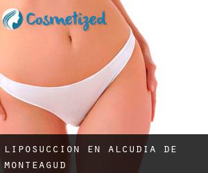 Liposucción en Alcudia de Monteagud