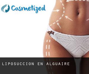 Liposucción en Alguaire