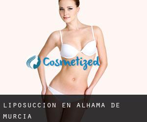 Liposucción en Alhama de Murcia Liposucción en Alhama de Murcia