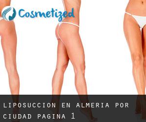 Liposucción en Almería por ciudad - página 1