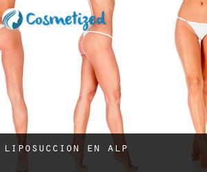 Liposucción en Alp