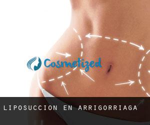 Liposucción en Arrigorriaga