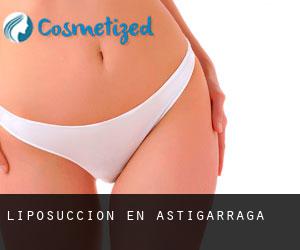 Liposucción en Astigarraga