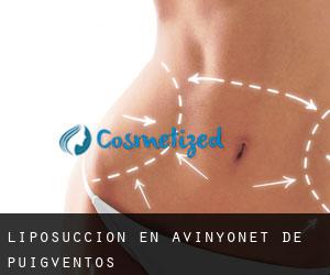 Liposucción en Avinyonet de Puigventós