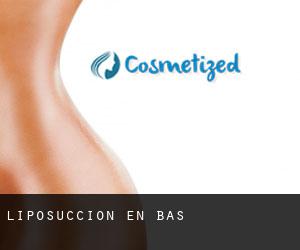 Liposucción en Bas Liposucción en Bas