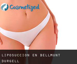 Liposucción en Bellmunt d'Urgell