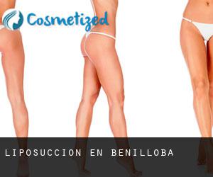 Liposucción en Benilloba