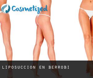 Liposucción en Berrobi Liposucción en Berrobi