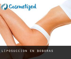 Liposucción en Boborás Liposucción en Boborás