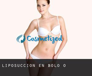 Liposucción en Bolo (O) Liposucción en Bolo (O)