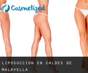 Liposucción en Caldes de Malavella