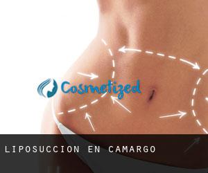Liposucción en Camargo