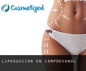 Liposucción en Campdevànol