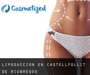 Liposucción en Castellfollit de Riubregós