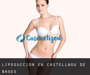 Liposucción en Castellnou de Bages