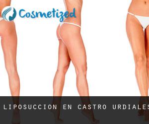Liposucción en Castro-Urdiales