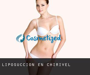 Liposucción en Chirivel