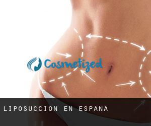 Liposucción en España