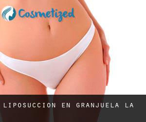 Liposucción en Granjuela (La)