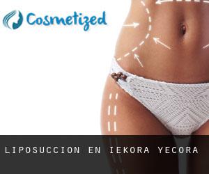 Liposucción en Iekora / Yécora Liposucción en Iekora / Yécora