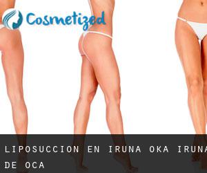 Liposucción en Iruña Oka / Iruña de Oca