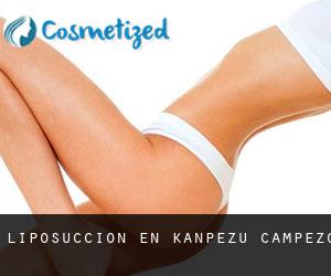 Liposucción en Kanpezu / Campezo