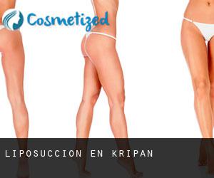 Liposucción en Kripan