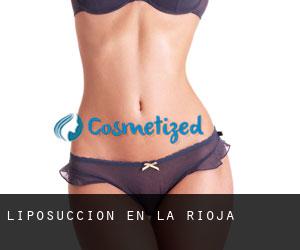 Liposucción en La Rioja Liposucción en La Rioja