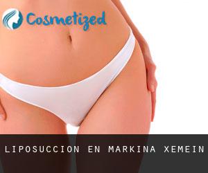 Liposucción en Markina-Xemein