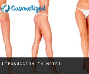 Liposucción en Motril Liposucción en Motril