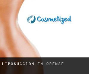 Liposucción en Orense Liposucción en Orense