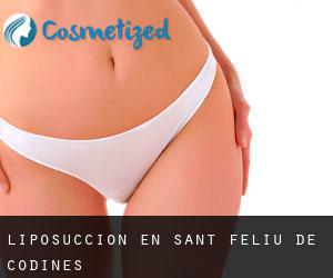Liposucción en Sant Feliu de Codines