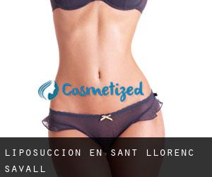 Liposucción en Sant Llorenç Savall