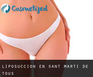 Liposucción en Sant Martí de Tous