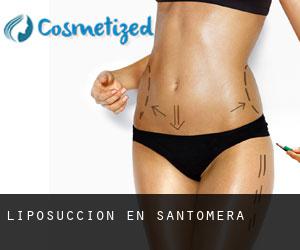 Liposucción en Santomera