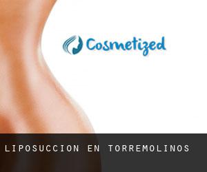 Liposucción en Torremolinos Liposucción en Torremolinos