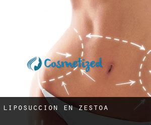 Liposucción en Zestoa