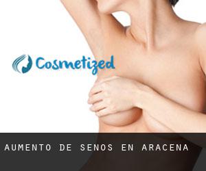 Aumento de Senos en Aracena Aumento de Senos en Aracena