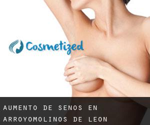 Aumento de Senos en Arroyomolinos de León Aumento de Senos en Arroyomolinos de León