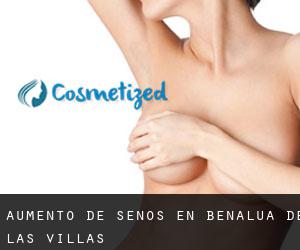 Aumento de Senos en Benalúa de las Villas Aumento de Senos en Benalúa de las Villas