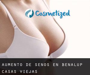 Aumento de Senos en Benalup-Casas Viejas Aumento de Senos en Benalup-Casas Viejas