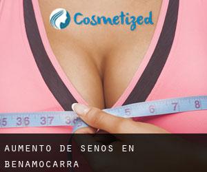 Aumento de Senos en Benamocarra Aumento de Senos en Benamocarra