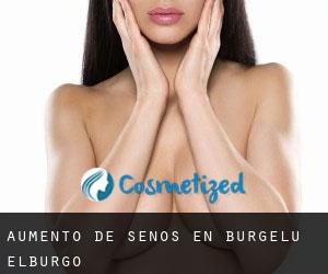 Aumento de Senos en Burgelu / Elburgo Aumento de Senos en Burgelu / Elburgo