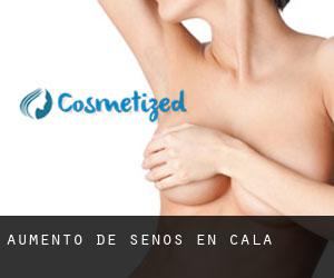 Aumento de Senos en Cala Aumento de Senos en Cala
