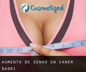 Aumento de Senos en Caner d'Adri Aumento de Senos en Caner d'Adri