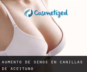 Aumento de Senos en Canillas de Aceituno Aumento de Senos en Canillas de Aceituno
