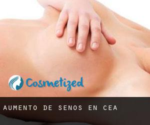 Aumento de Senos en Cea Aumento de Senos en Cea