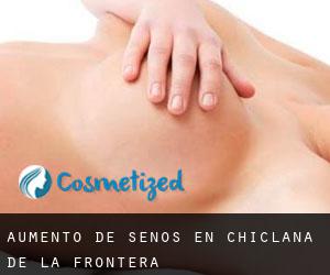 Aumento de Senos en Chiclana de la Frontera Aumento de Senos en Chiclana de la Frontera